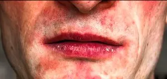 این علامت روی پوست خبرهای بدی دارد!