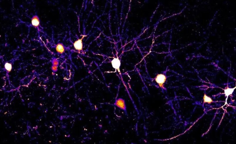 synapses learning neuroscience