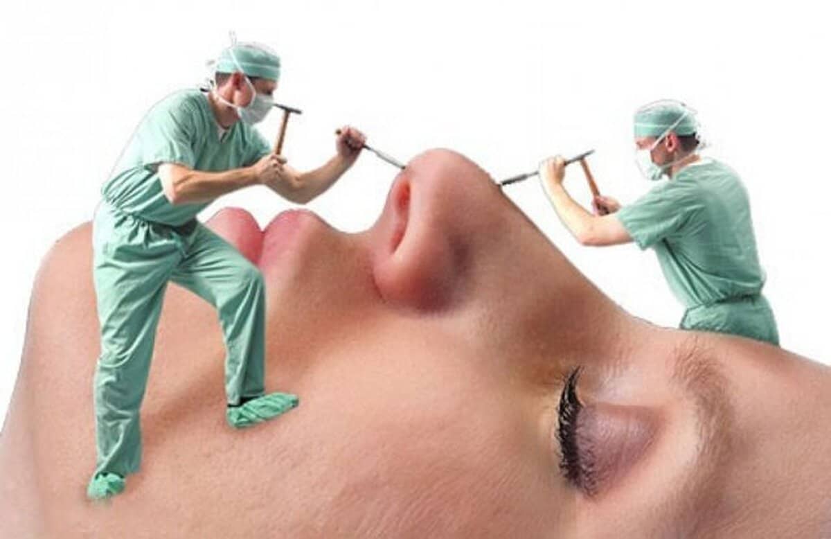 تقاضای رو به رشد عمل زیبایی | فضای مجازی مرجع تخصصی تبلیغ جراحی پلاستیک نیست | شهرآرانیوز