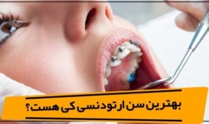 ارتودنسی در بزرگسالی | هنوز هم می‌تونید لبخند زیباتری داشته باشید!
