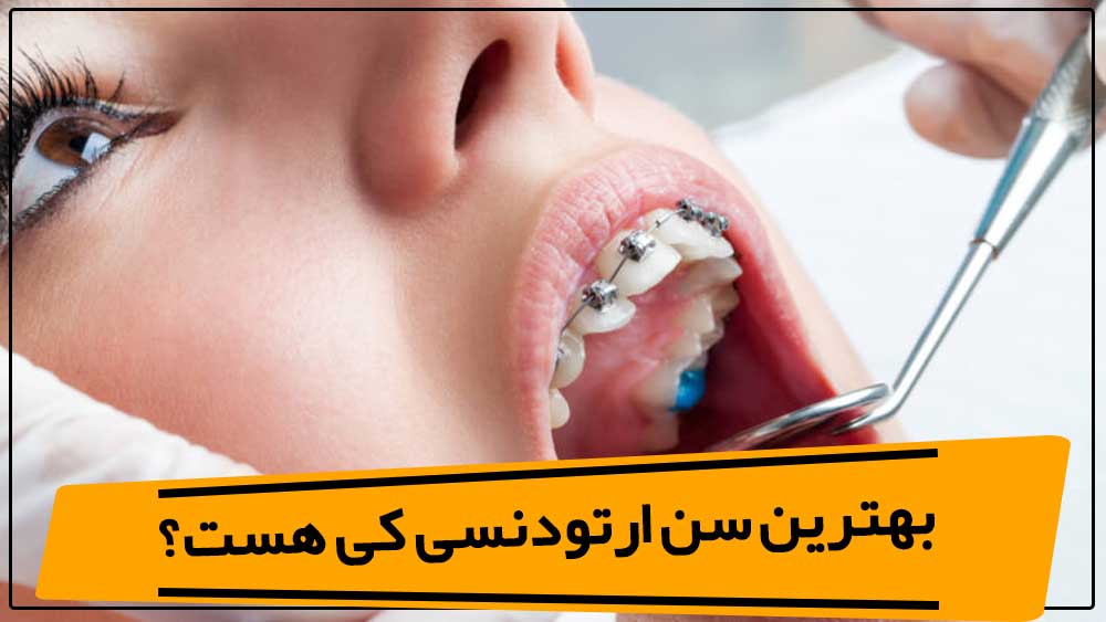 1a651e5f-977d-45b9-9f77-75ac4c0fcdc1 ارتودنسی در بزرگسالی | هنوز هم می‌تونید لبخند زیباتری داشته باشید!