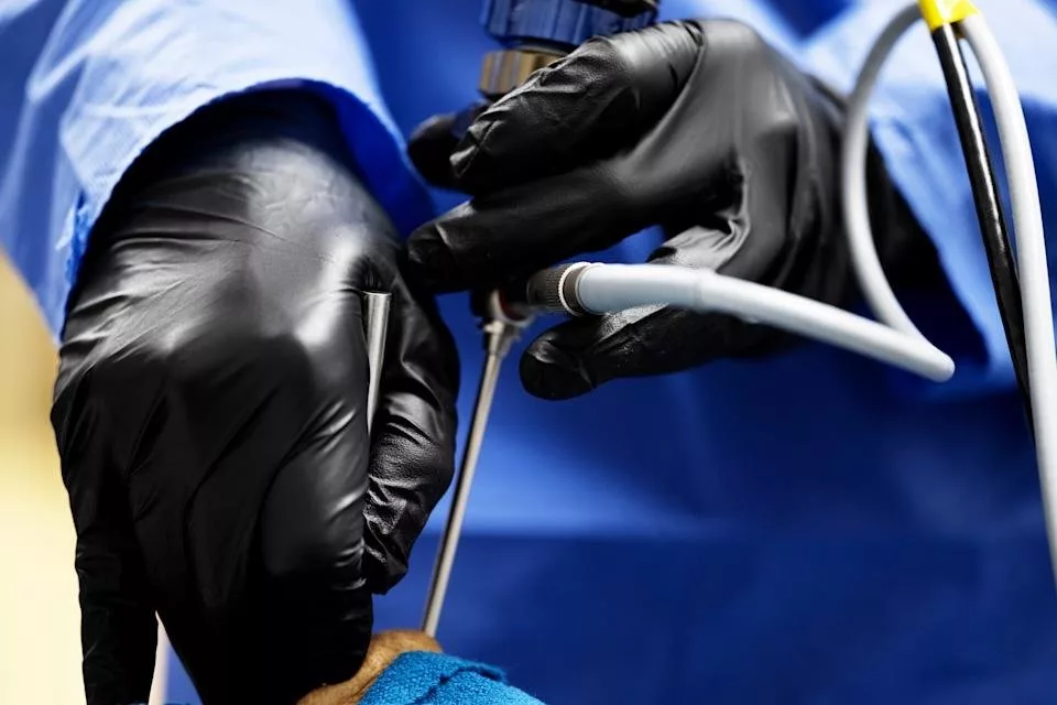 ابتکار پزشکان در آمریکا: برداشتن تومور نخاعی برای اولین بار از طریق حدقه چشم بیمار