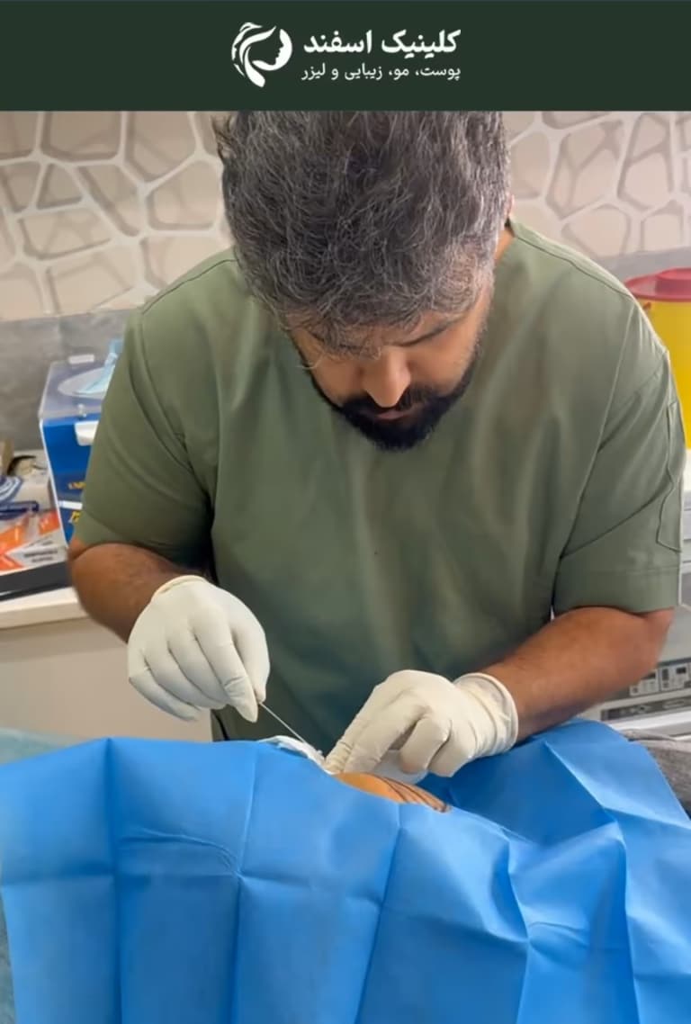 قیمت لیفت صورت با نخ | آنچه باید درباره این روش جوان‌سازی بدانید
