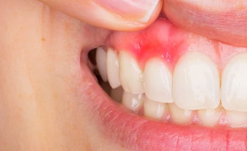 6f7b7caa c76e 4fda 95c9 9b4bff4af2a6