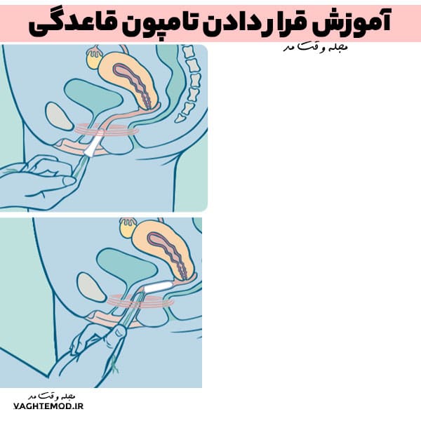 آموزش قرار دادن تامپون قاعدگی در مجله سلامتی وقت مد.