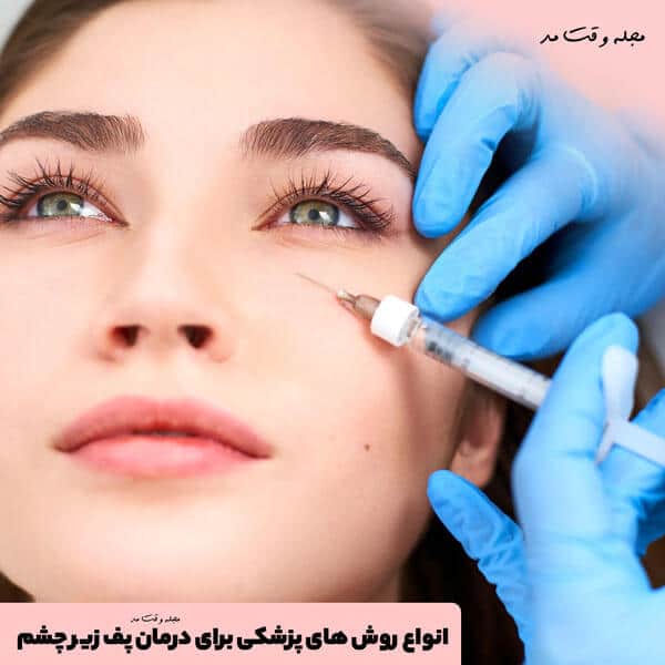 انواع روش های پزشکی برای درمان پف زیر چشم