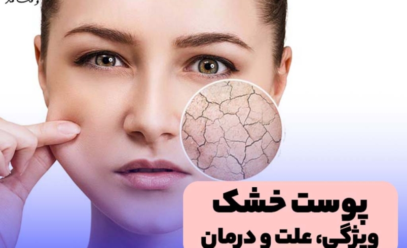 همه چیز درمورد پوست خشک! با عوامل، ویژگی ها، علائم، روش های پیشگیری و درمان خشکی پوست آشنا شوید