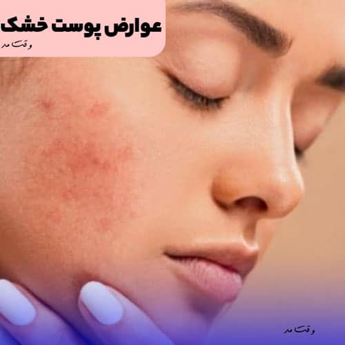 عوارض و بیماری ناشی از پوست خشک را مشاهده میکنید.
