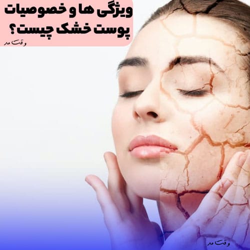پوست خشک چیست؟