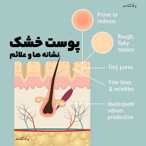 علت خشک شدن پوست صورت را مشاهده میکنید.