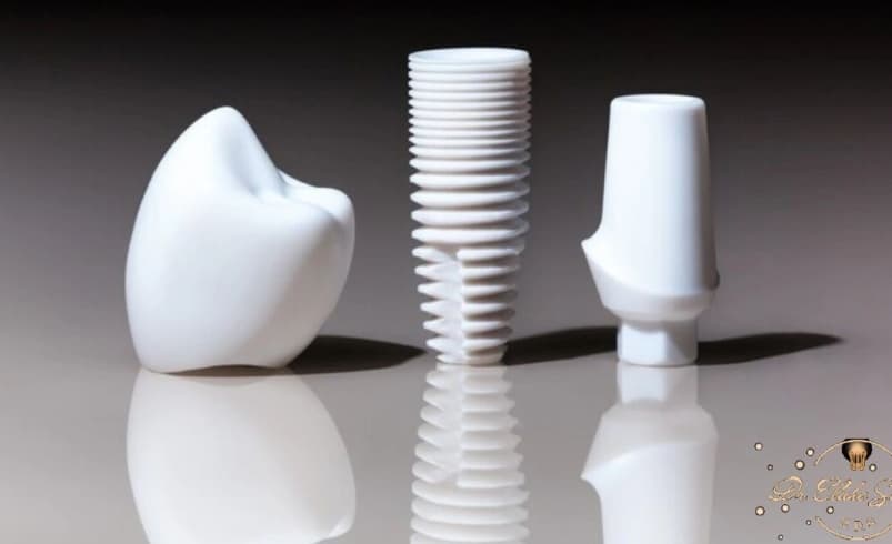 ایمپلنت پانچی؛ روش جدید کاشت دندان با درد کمتر و بهبودی سریع‌تر