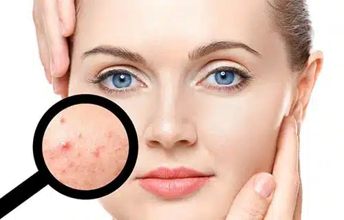 74ca8c9c cc40 420d 96f3 cab5088adb9a