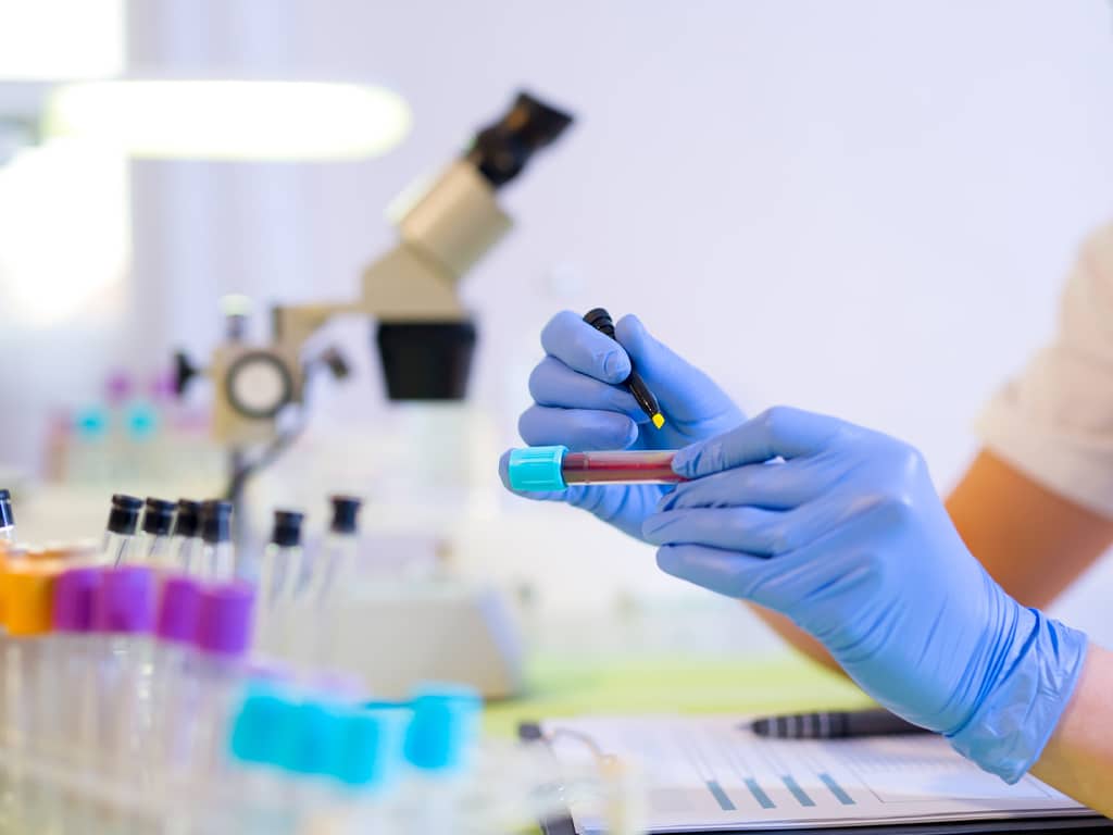 اصلی ترین علائم سکته قلبی چیست