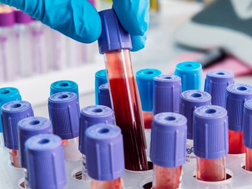 آزمایش خون برای سکته قلبی در منزل