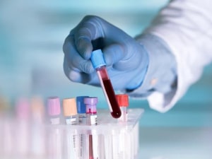 همه چیز در مورد علائم سکته قلبی در آزمایش خون