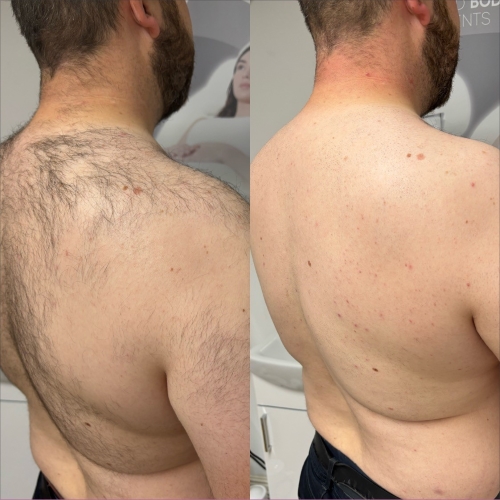 تکنولوژی‌های ایده‌آل برای پوست و موی آقایان