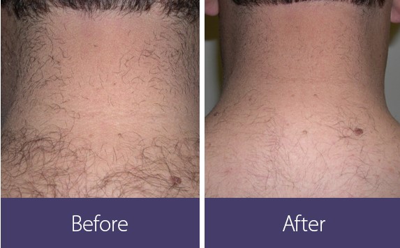 ۱. ماهیت و ویژگی‌های موهای مردانه