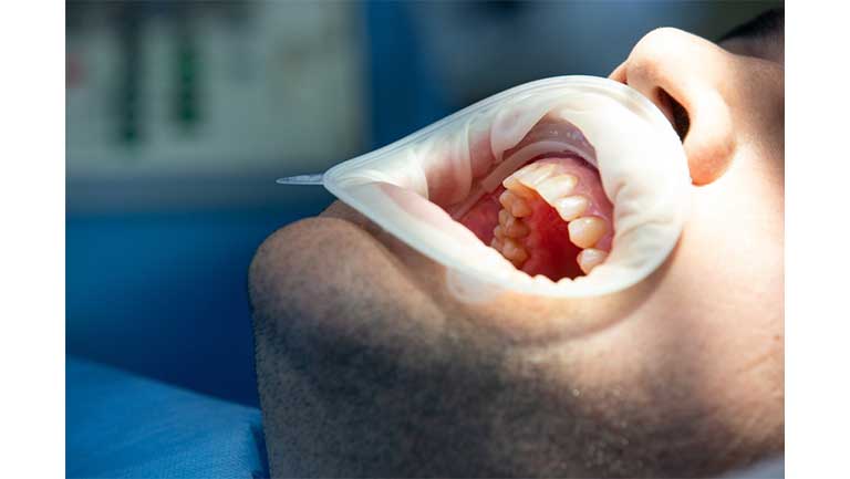 آیا جراحی لثه درد دارد؟