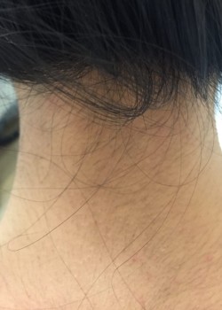  ماهیت و ویژگی‌های موهای مردانه