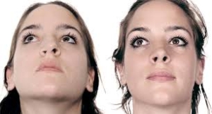 علت پهن شدن پره های بینی بعد از عمل