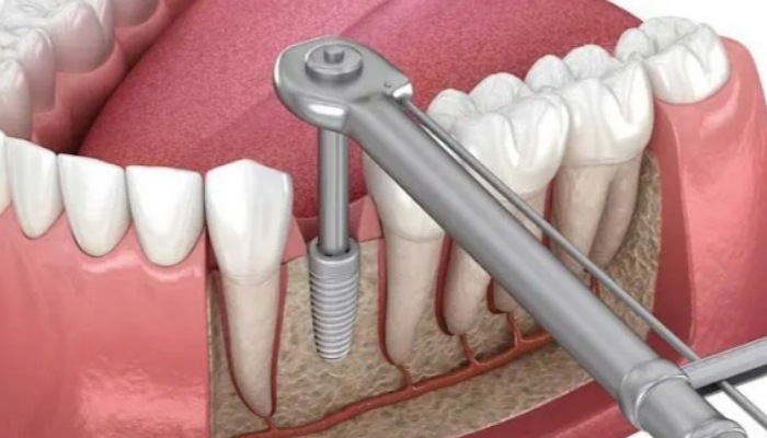 VMl9deqeBJv6niwj75mLAI80zGzky5ouvXk97WOM