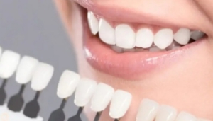 صفر تا صد روش‌های دندانپزشکی زیبایی: ایمپلنت و لمینت با جدیدترین متدها